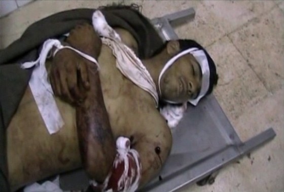 A still image taken from an amateur video on April 22, 2011 shows a body in a hospital in Deraa