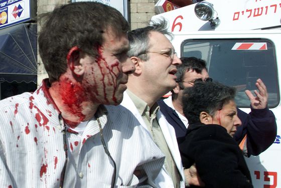 INJURED ISRAELIS AFTER A SUICIDE BOMBING IN CENTRAL JERUSALEM