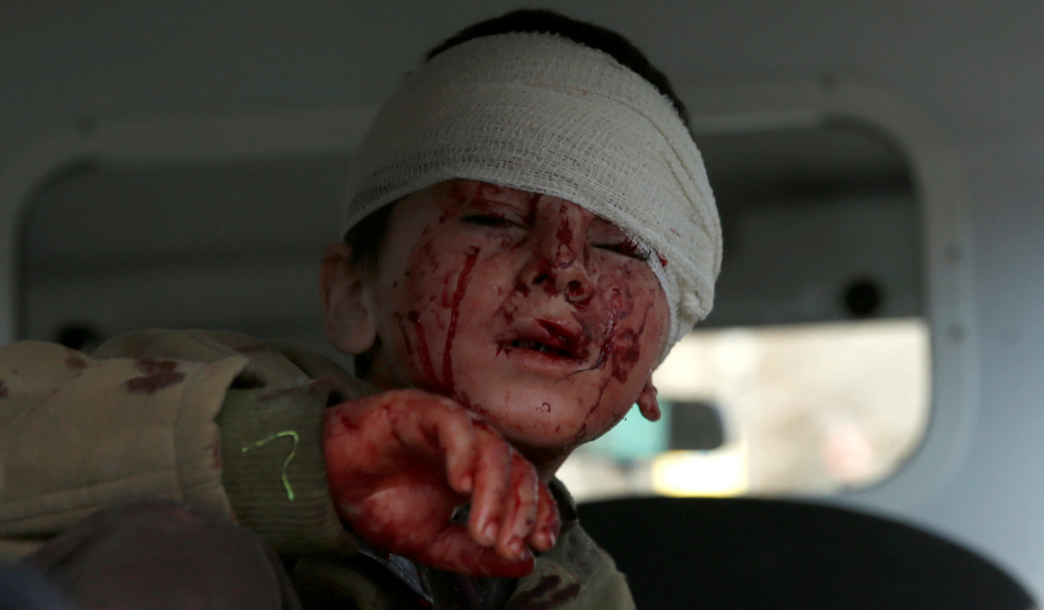 Kabul: 95 drept og 158 såret i bilbombe&shy;angrepet&nbsp;<span>(+)</span>