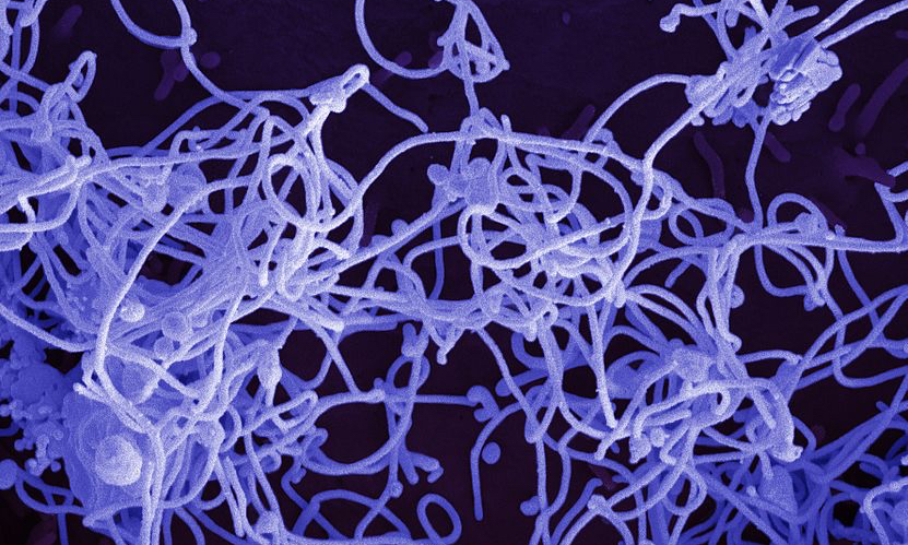 Pasient med mulig ebola undersøkes i Malmö&nbsp;<span>(+)</span>