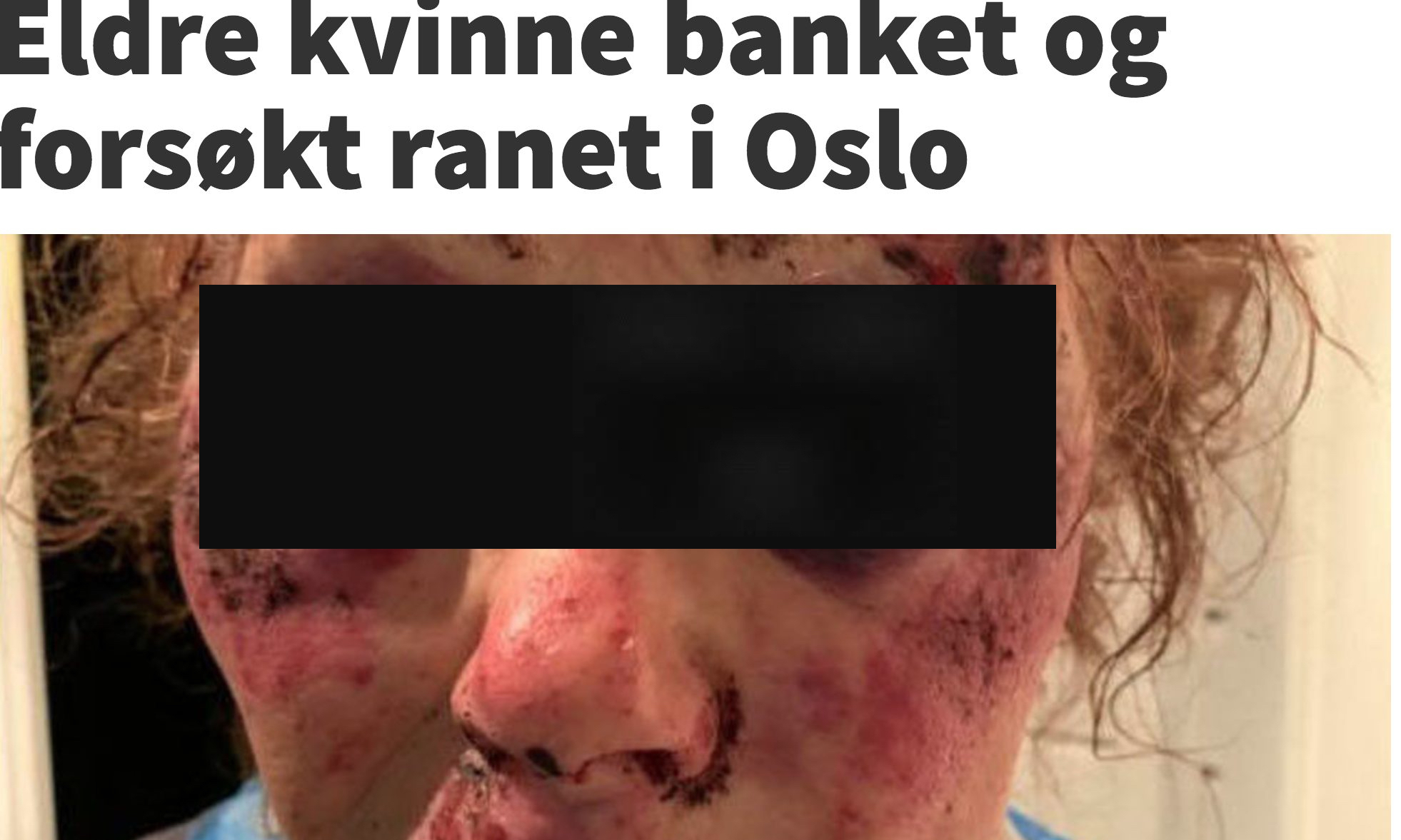 - Skal man tie og godta at tingene ikke er som før i vår by Oslo?&nbsp;<span>(+)</span>