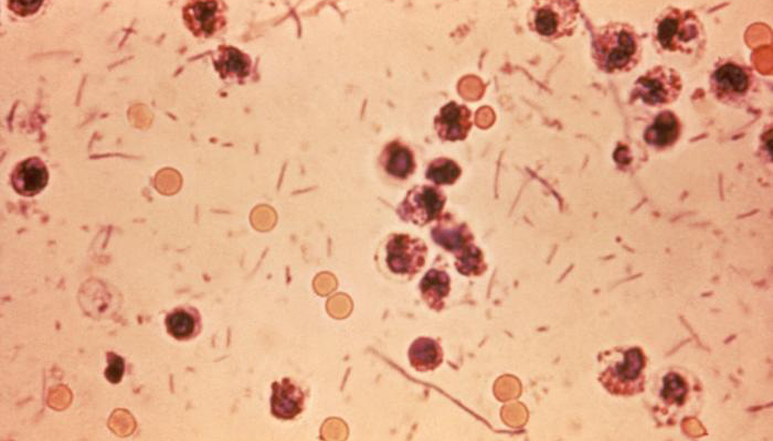 Barneskole­elever smittet av dysenteri&nbsp;<span>(+)</span>