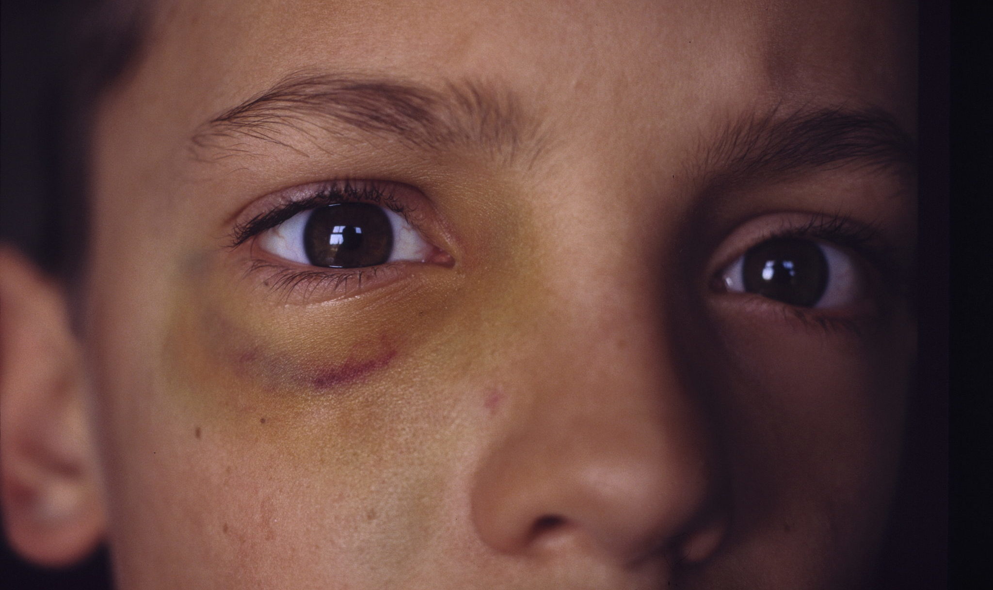 Rapport: 1 av 20 har opplevd grov vold fra foreldre&nbsp;<span>(+)</span>