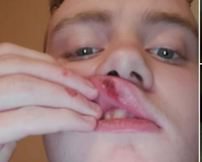 17-årige Marcus forsøgt skubbet ned på skinnerne, “… kendte dem ikke engang”&nbsp;<span>(+)</span>