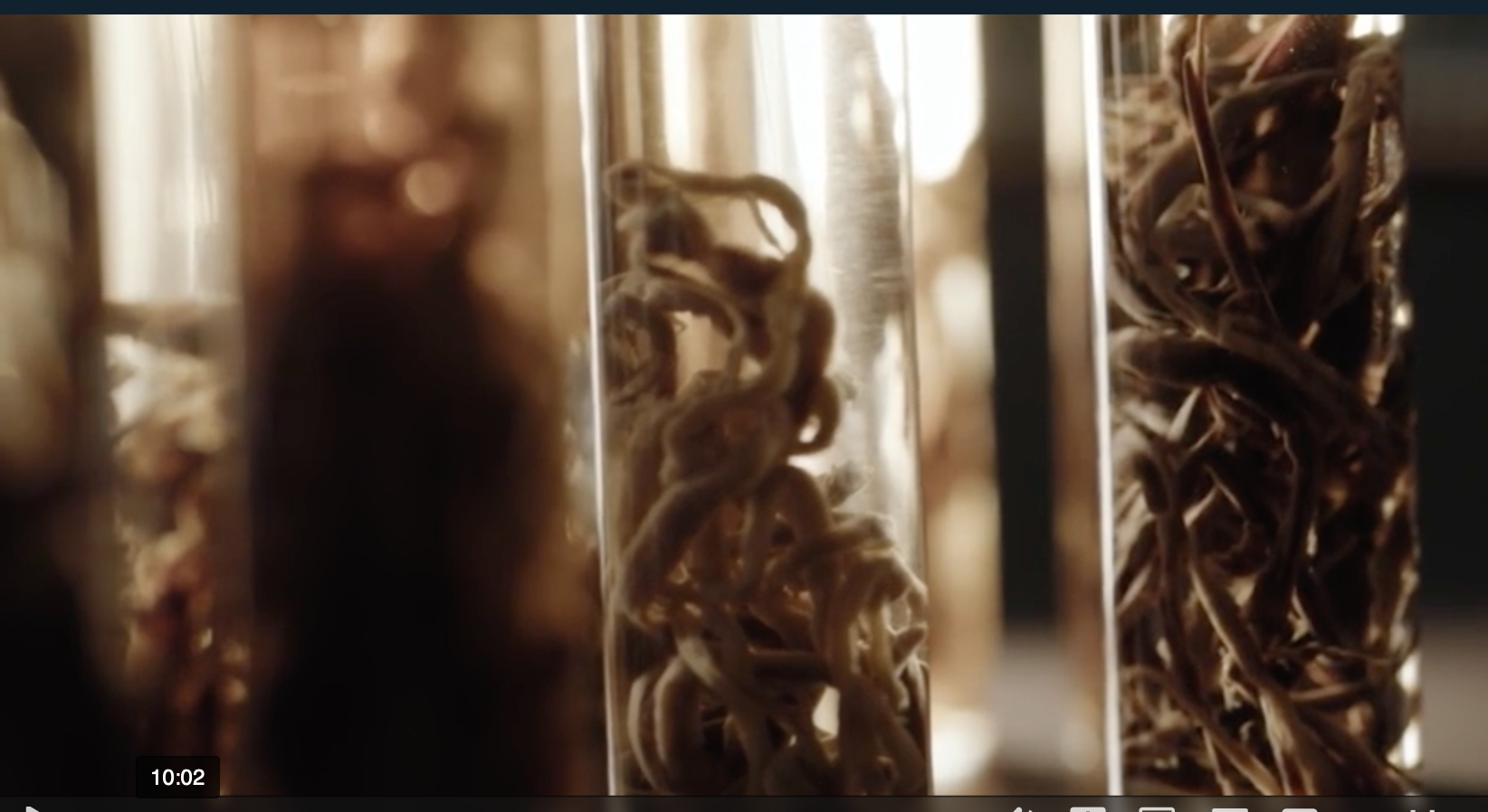 Kroppen din er invadert av dem som sa de skulle hjelpe deg&nbsp;<span>(+)</span>