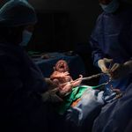 – Hjernedøde kvinner bør kunne brukes som surrogat­mødre