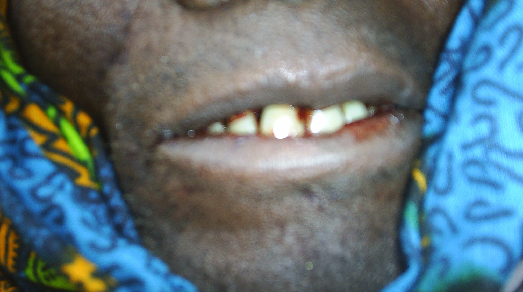 Marburg i Tanzania&nbsp;<span>(+)</span>