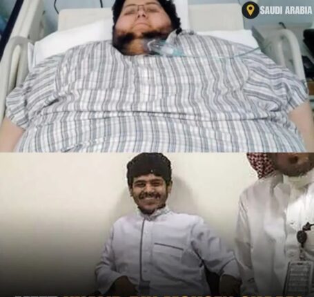 Var verdens tjukkeste mann – slanket seg 542 kilo