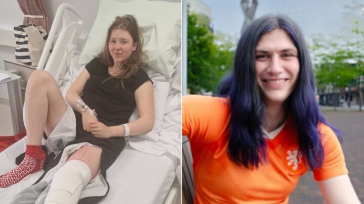 Elena (20) fikk kneet revet ut av ledd: – En kvinne hadde aldri klart det