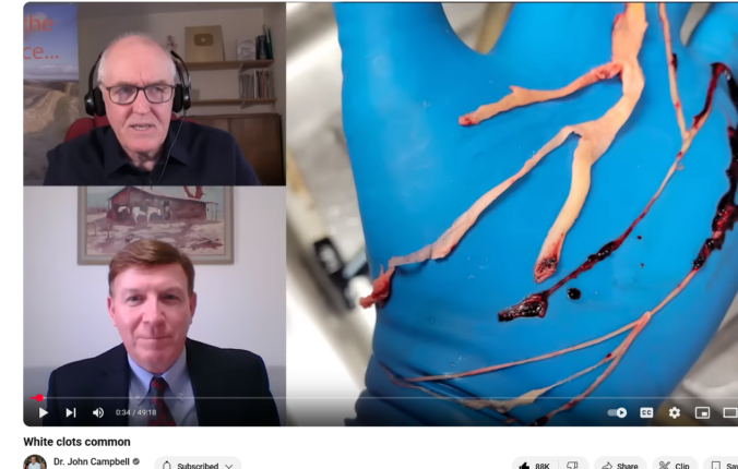 Hva er de merkelige hvite blodproppene mange balsamerere har sett siden 2021?