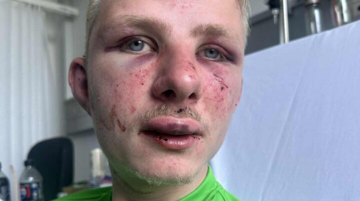 Sannheten om grov vold begått av utlendinger er i ferd med å snike seg inn