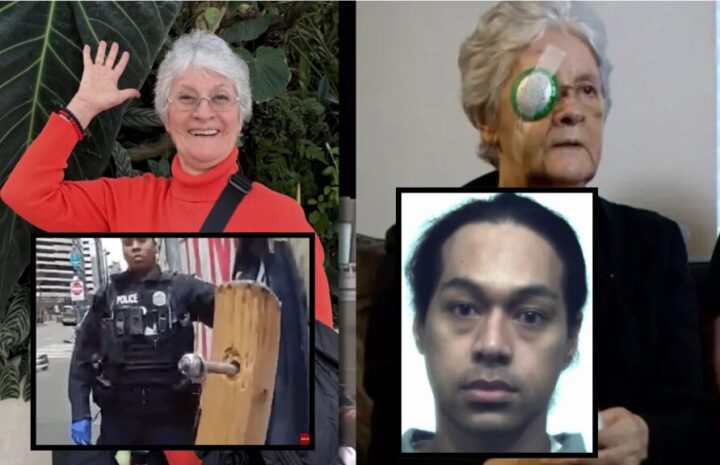 75-årig kvinne blind på ett øye etter brutalt overfall av notorisk gjenganger i Seattle