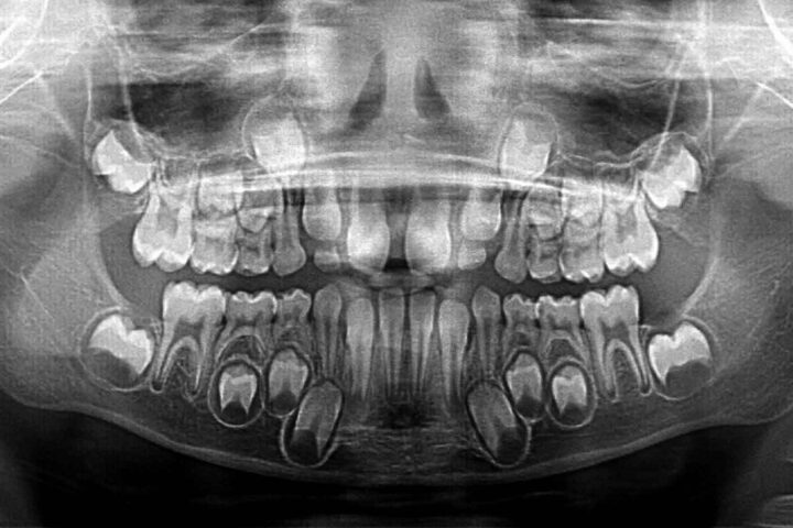 Godt nytt for godt voksne: Japanske forskere får tapte tenner til å gro ut igjen