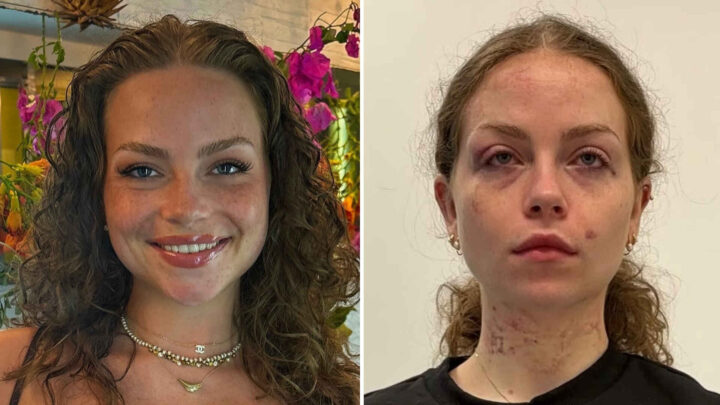 Carlos (25) dømt for å ha voldtatt Emma: – Straffen er helt latterlig