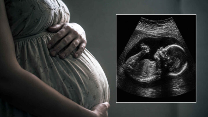 Homopar krevde surrogatbarn abortert på grunn av hareskår – saksøker nå kvinnen&nbsp;<span>(+)</span>